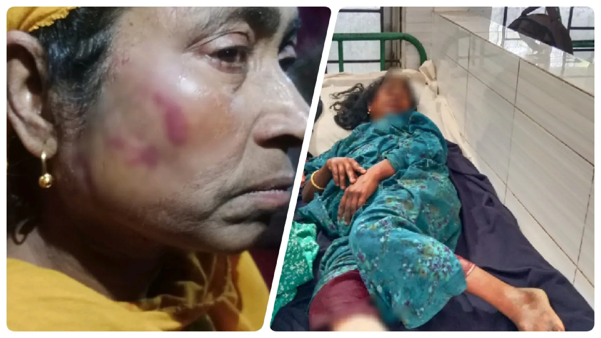 ফুলবাড়ীতে জমির বিরোধে নারীকে হত্যার চেষ্টা , সরিষা খেতে আগুন