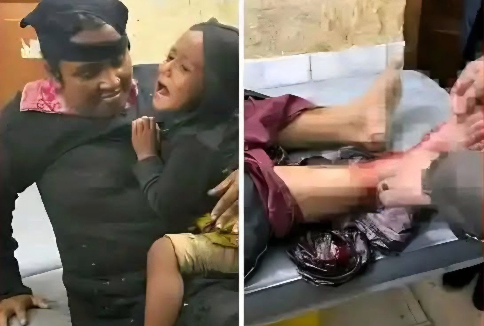 ভয়াবহ দুর্ঘটনায় পা ভেঙে চুরমার, তবুও কোলছাড়া করেননি সন্তানকে: বিশ্ব দেখল মায়ের ভালোবাসার এক অনন্য দৃষ্টান্ত
